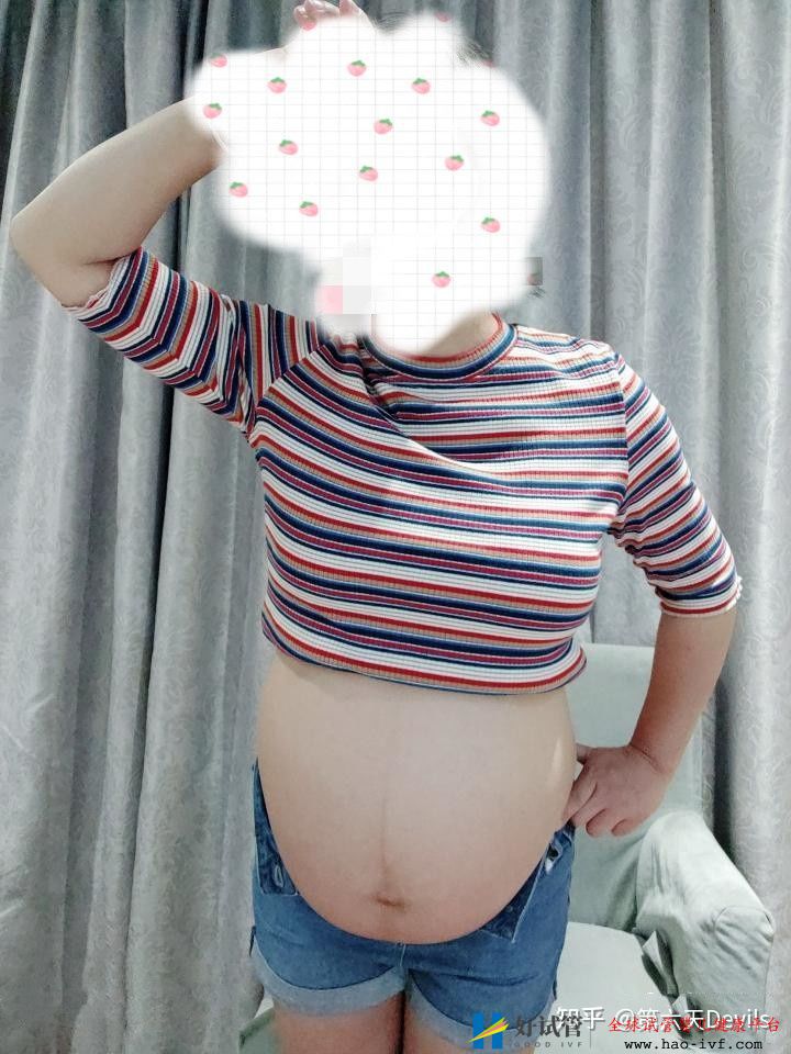 35岁卵巢早衰做供卵试管成功怀上了宝宝,分享我的经(图3) 35岁卵巢早衰做供卵试管成功怀上了宝宝,分享我的经(图3)