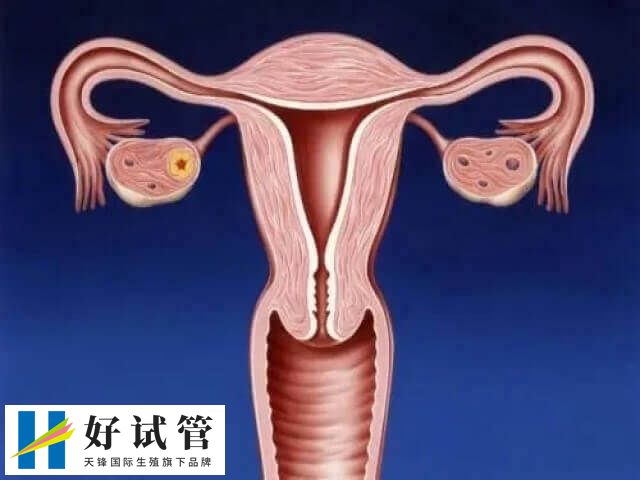 amh低说明女性卵巢供下降