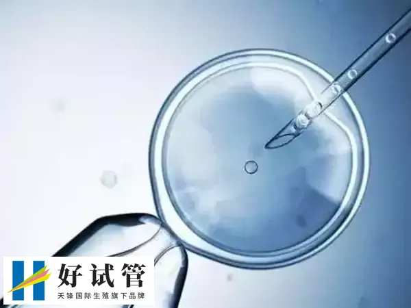 格鲁吉亚试管技术比较不错