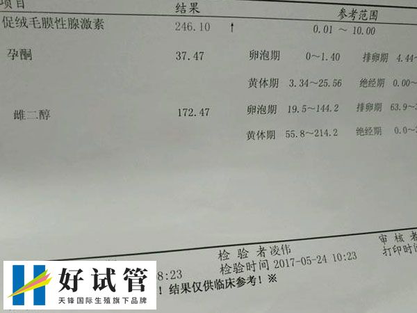 频繁检查孕酮和hcg可能会增加焦虑
