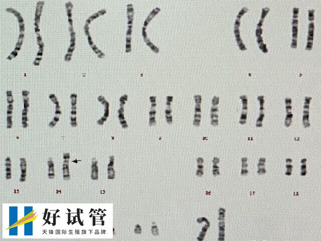 三代试管短方案进周前需进行建档